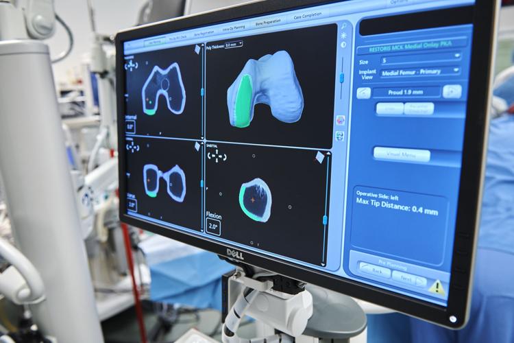 gamechanger' Surgical robotic arm takes Geisinger into the