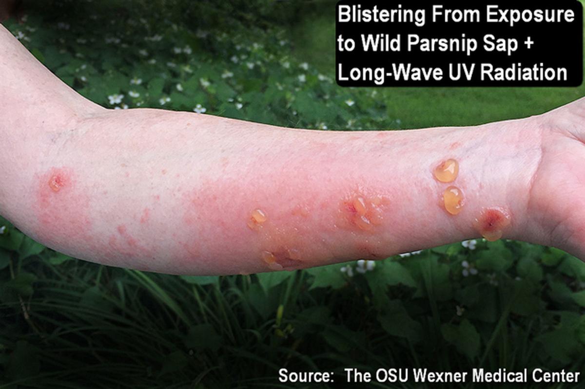 Poison hemlock and wild parsnip thriving in southern Ohio News