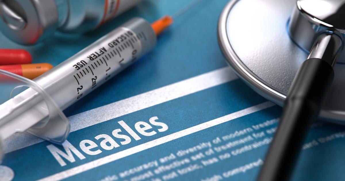 First cases of Arizona Measles this year in Navajo County