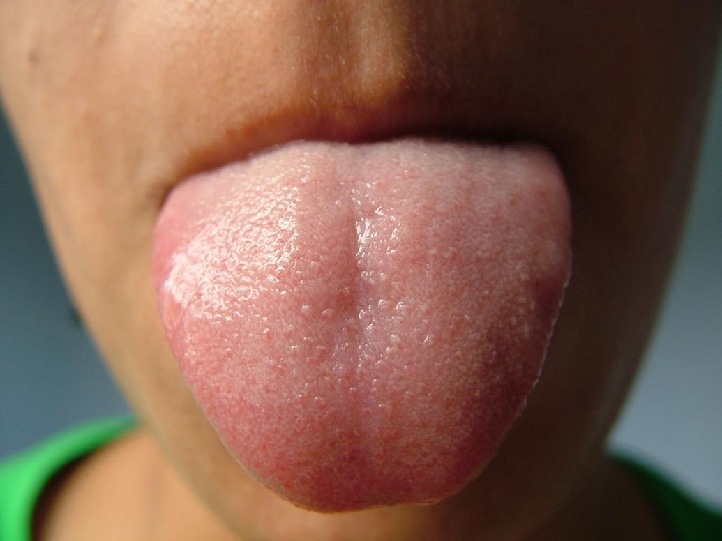 Can nerve endings in the tongue help us treat traumatic brain injury