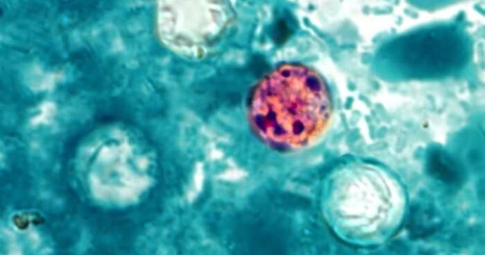 Waterloo expert : How to avoid the severe diarrhea parasite