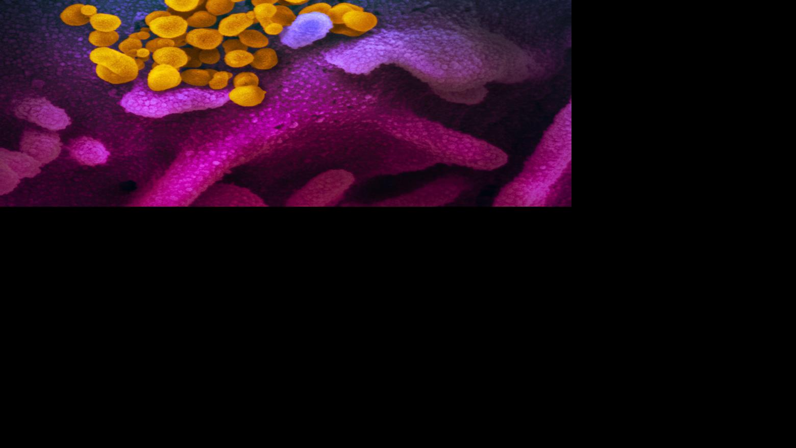 See Where And How Fast Virus Cases Are Rising In Our State And Nation In 8 Maps And Charts National News Nonpareilonline Com