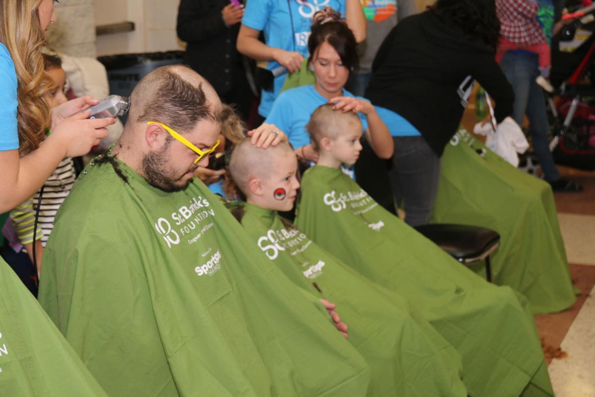 Teaming up for baldness