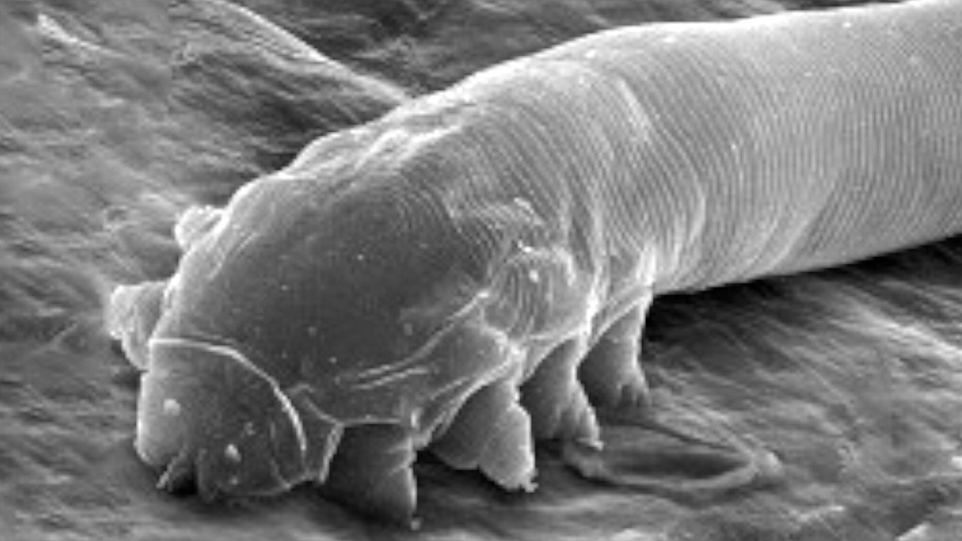 Did you know your face is covered in tiny mites?