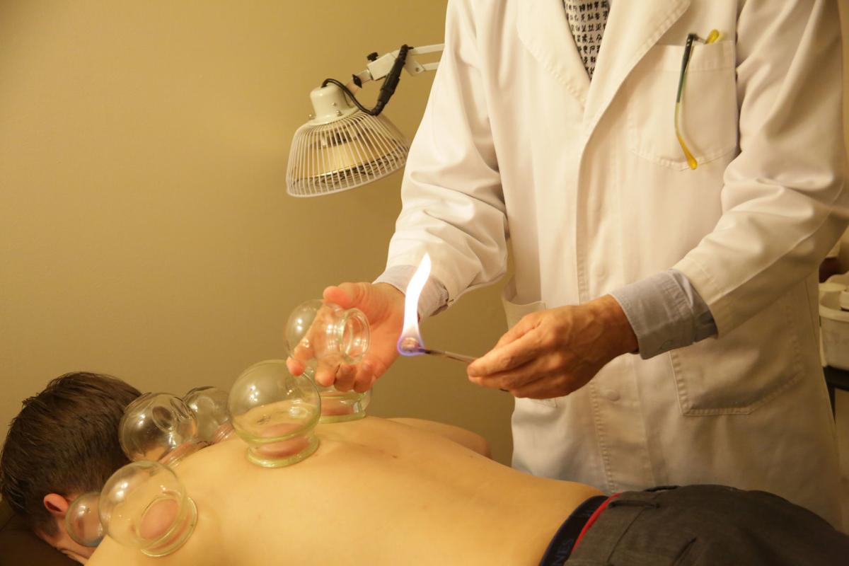 Cupping growing in popularity in Northwest Indiana | Healthy Living