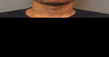 UPDATE: Man blinded in beating; police find gun in lake during investigation - Vimarsana News