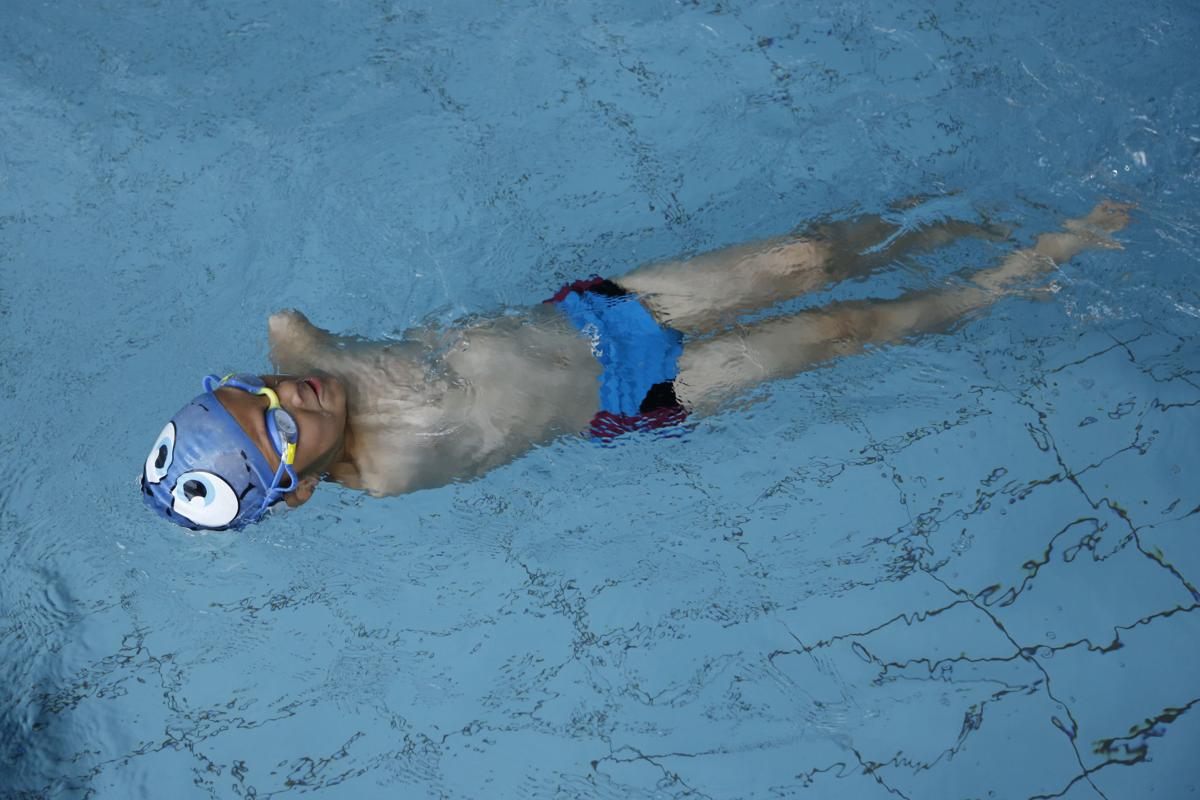 Photos He was born without arms. Now, he's a swimming champion Digital Exclusives Photo