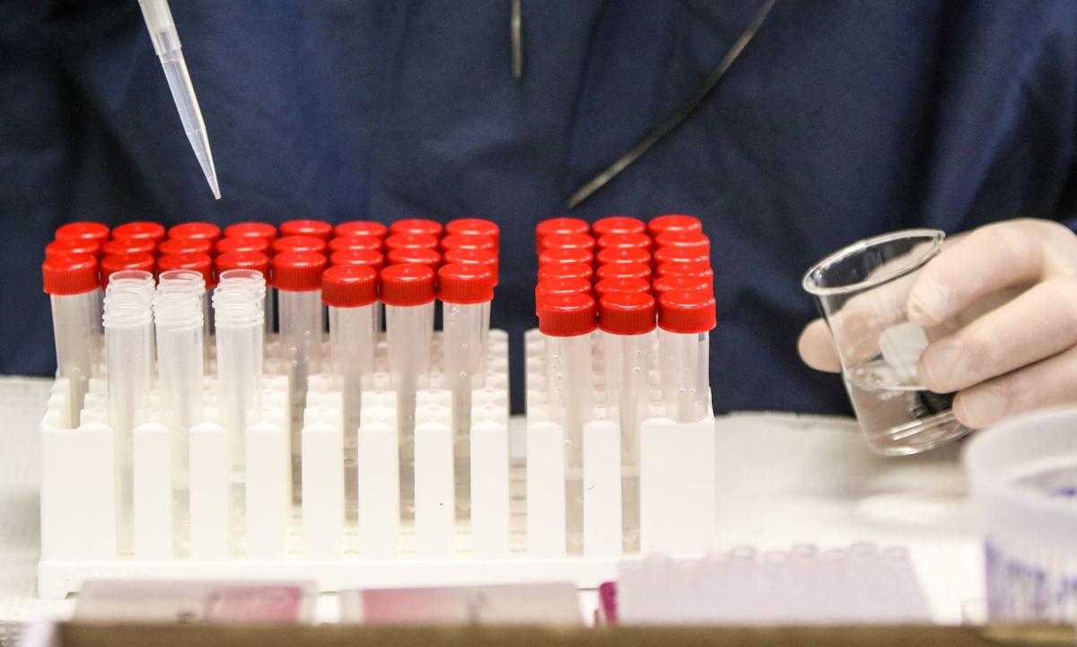 Virus testing at Great Lakes Labs