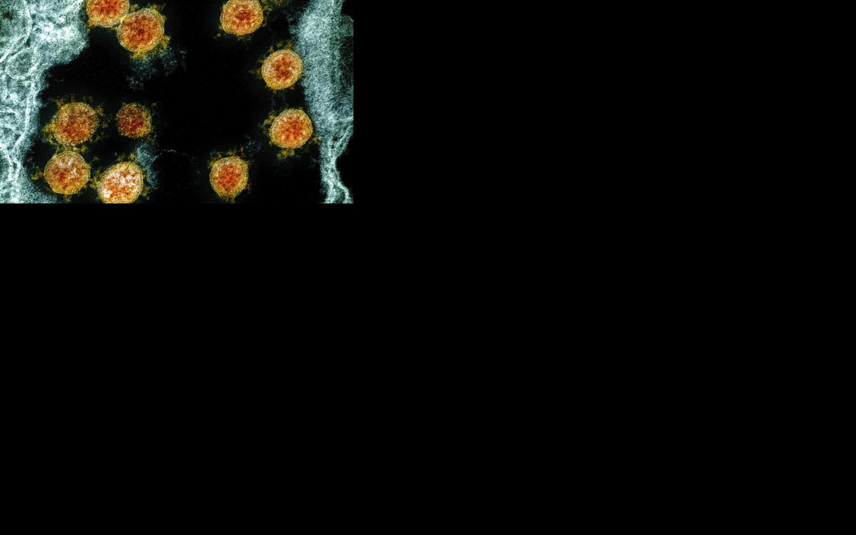 Asset-image