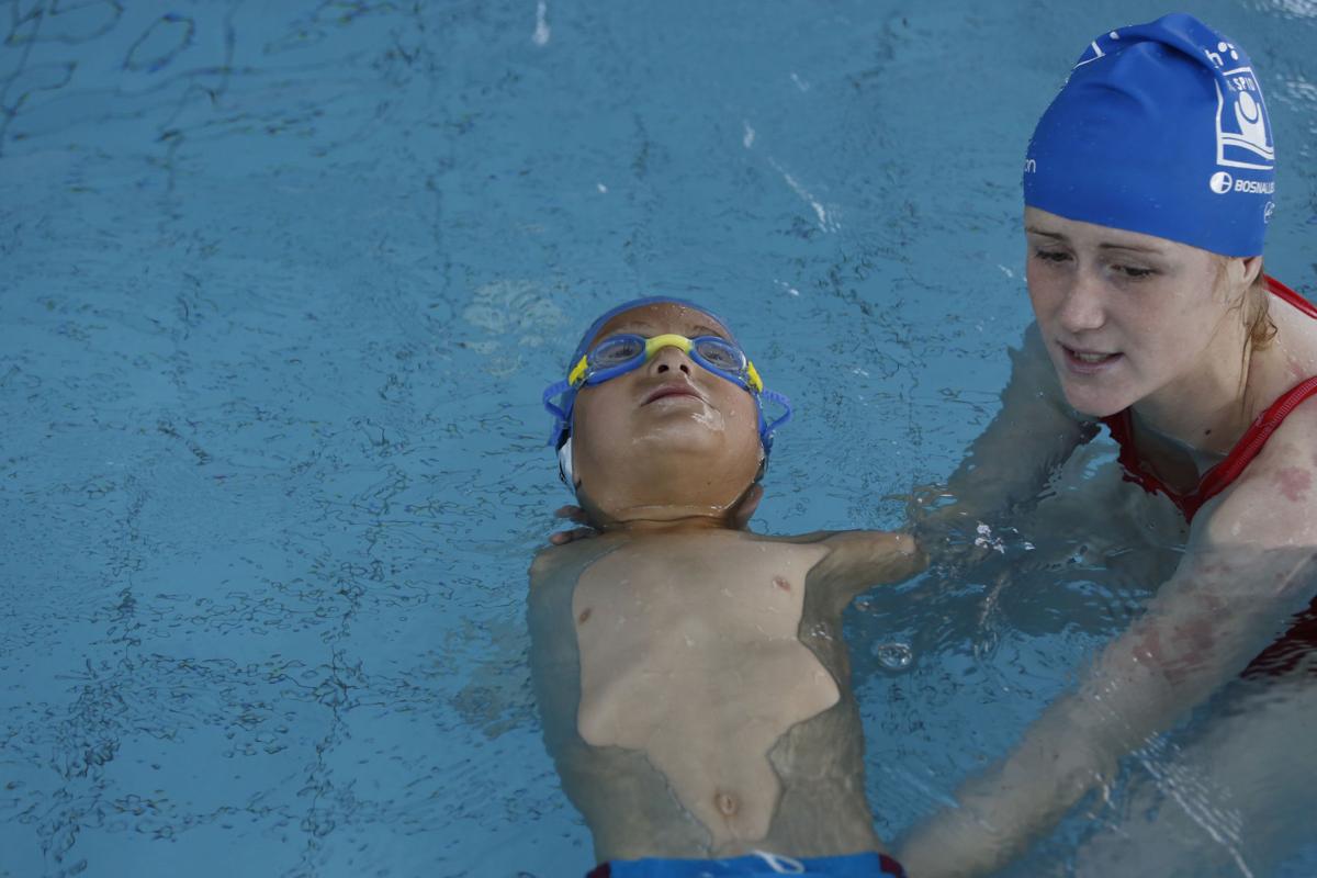 Photos He was born without arms. Now, he's a swimming champion Digital Exclusives Photo