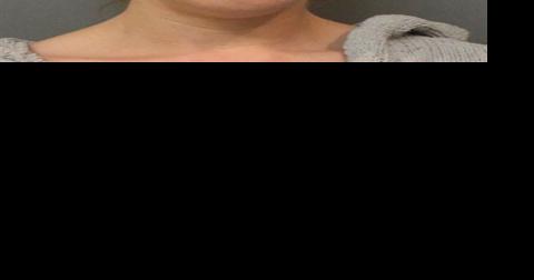 Former waitress admits she touched co-worker with knife while 'horsing around' - Vimarsana News