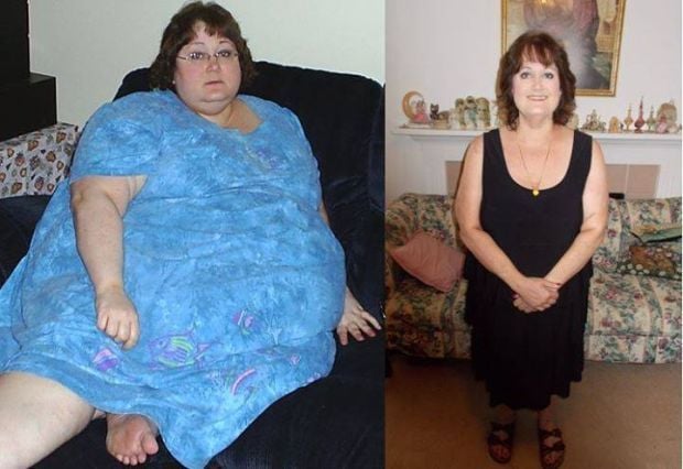 before and after weight loss without surgery