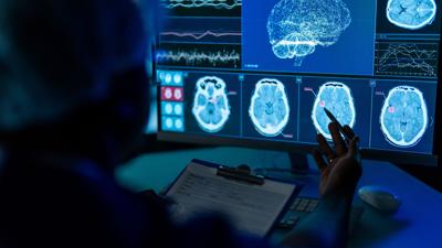 Brain Health