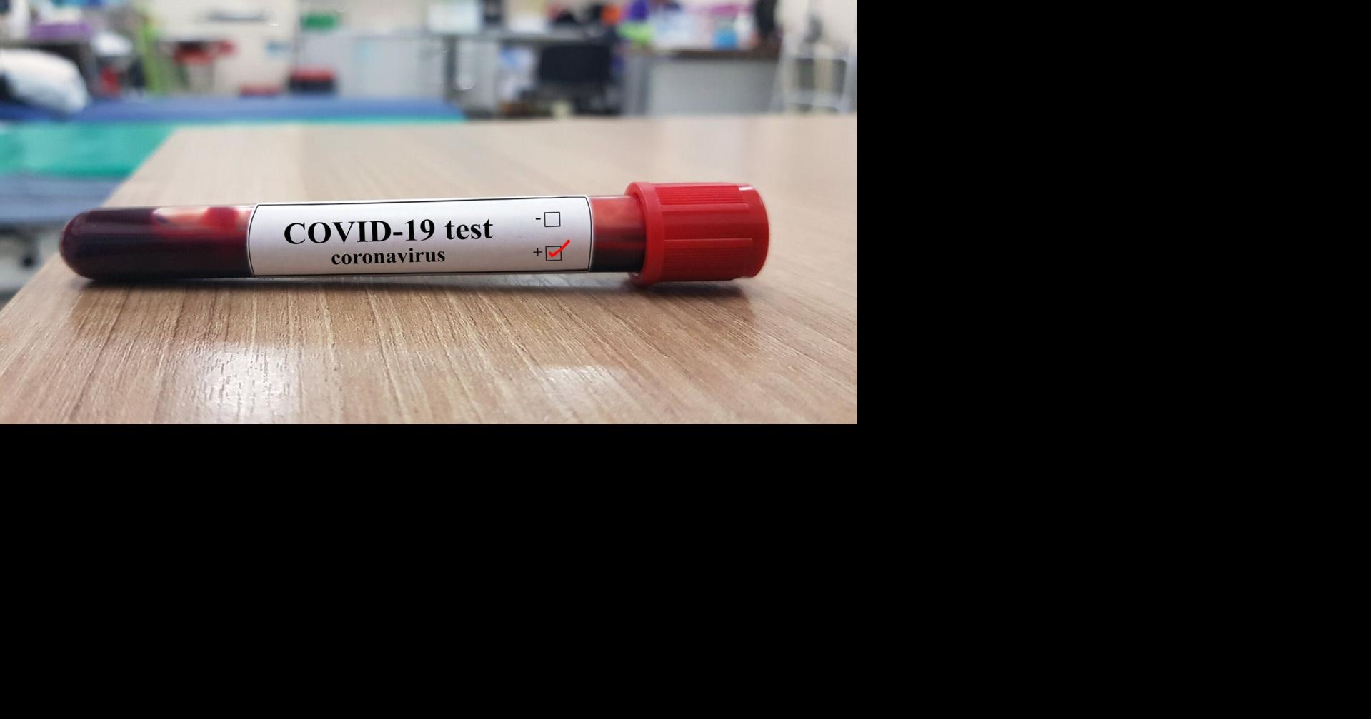 Want to know if you’ve had the coronavirus? LifeLabs COVID19 antibody