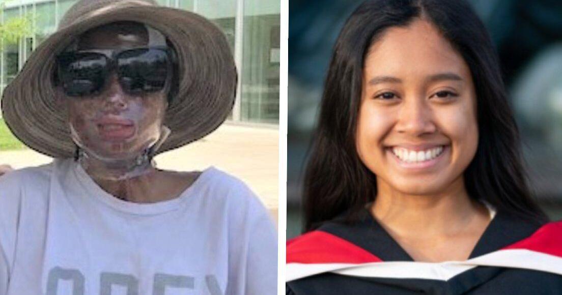 ‘Serious and life altering': The disturbing details behind the Ontario sulphuric acid attack on a niece by her aunt