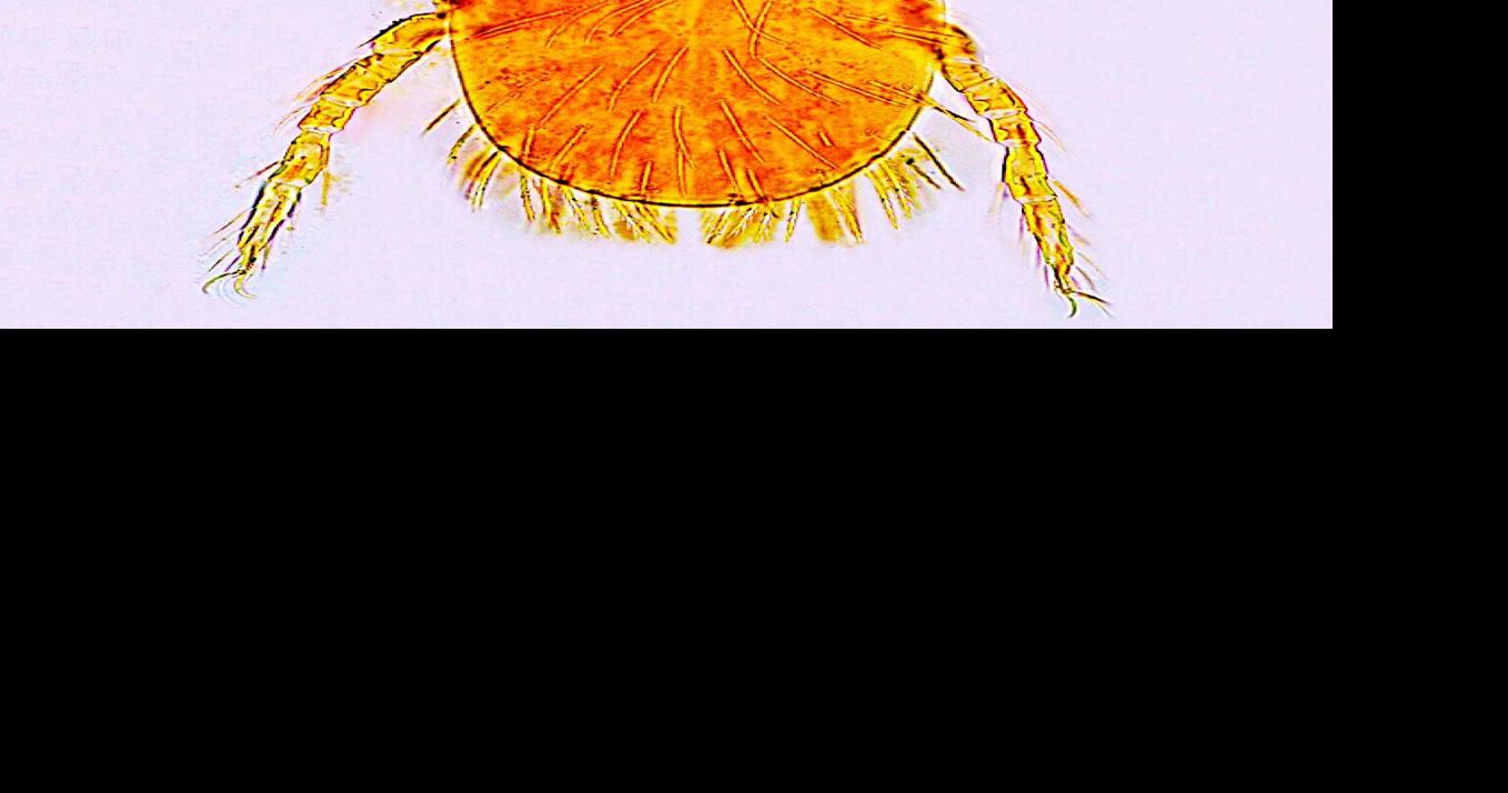 Mite misery: You won't see the chigger, but you'll feel the itch ...