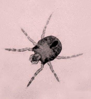 Chigger activity booming, and results could be itchy