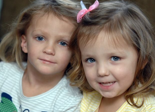 turner syndrome pictures children