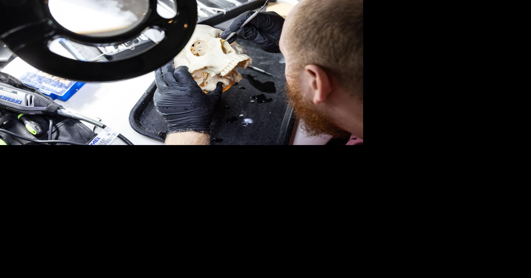 Dallas implant designer channels artistic talent to repair mangled skulls and jaws