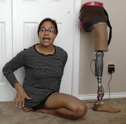 Double amputee shares her story of leaving the wheelchair behind