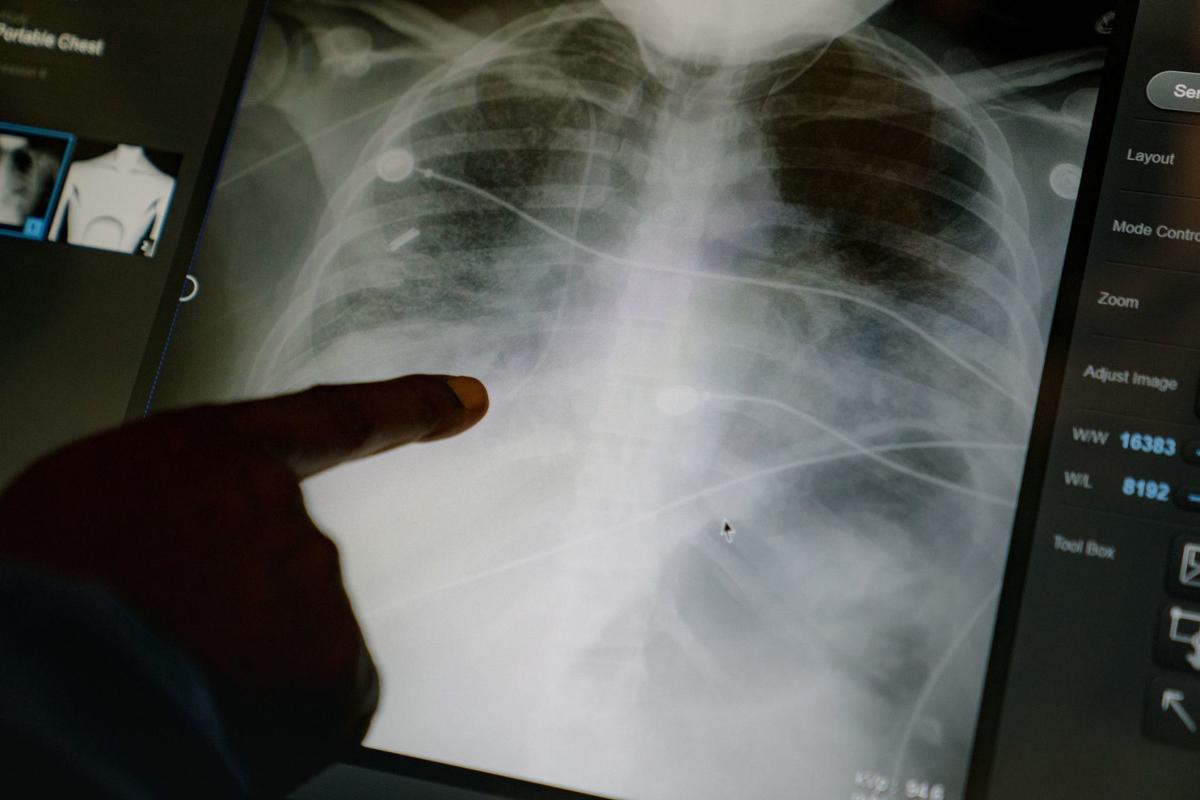 Cdc Adds 6 Covid 19 Symptoms To Its List Health Pantagraph Com