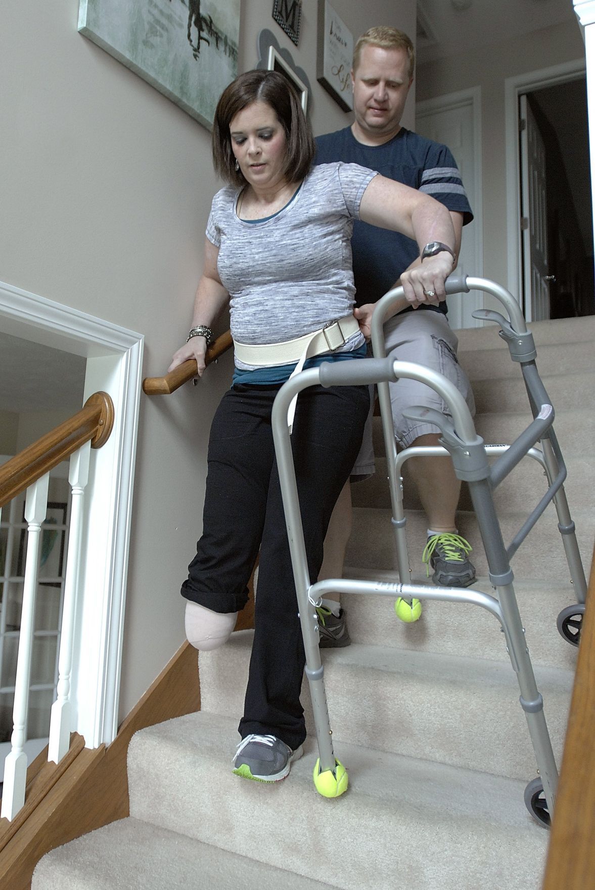 Young woman chooses amputation to be there for family Health 