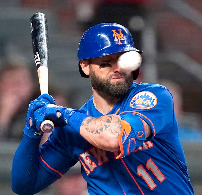 Mets' Pillar has multiple nasal fractures after hit by pitch