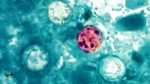 Canada updates U.S. travel advisory over rapidly spreading cyclospora outbreak
