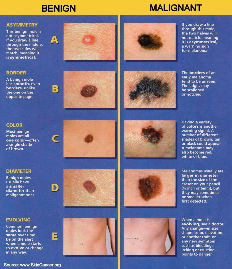 itchy skin tags