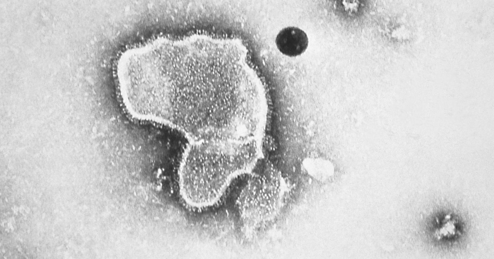 Study shows new infant RSV antibody shot highly effective, making Delaware Valley pediatricians hopeful for more protections next fall - Vimarsana News