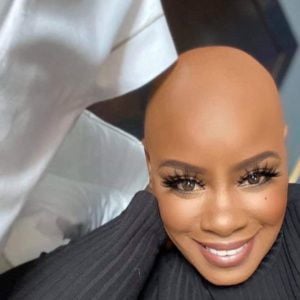 Bald, Black and Beautiful: Houston women share their stories | |  phillytrib.com