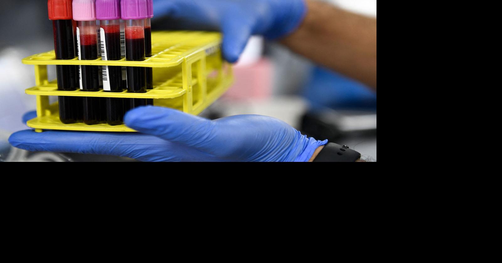 Tips to be Fit More information about getting a blood test done