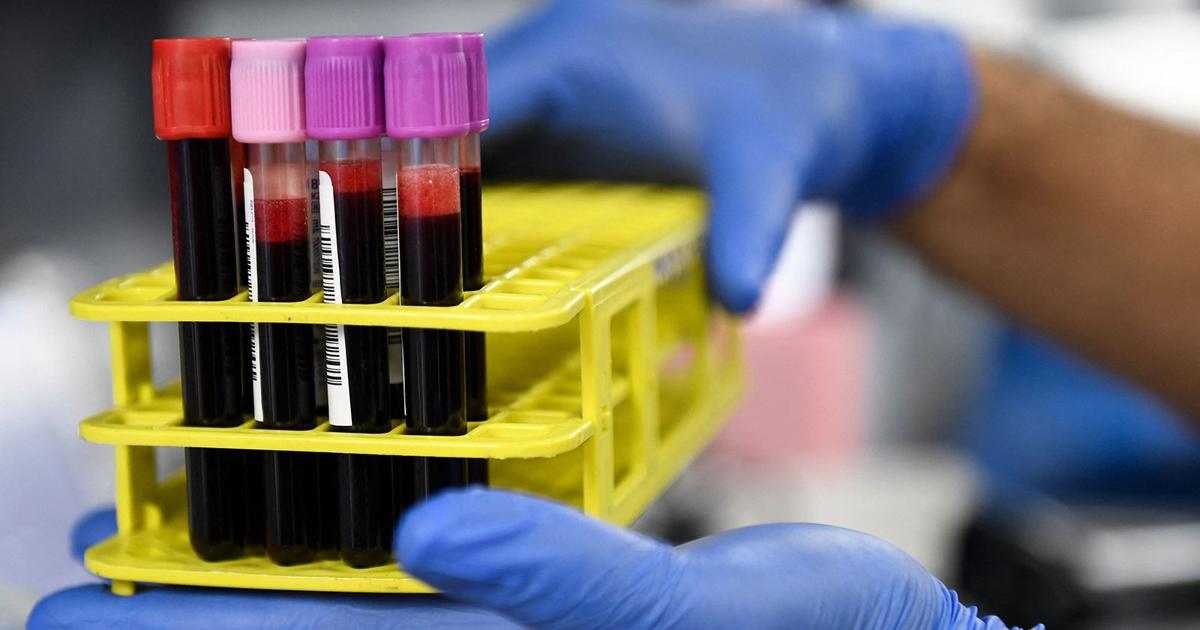 Getting Lab Work Done Tips to be Fit: More information about getting a blood test done ...
