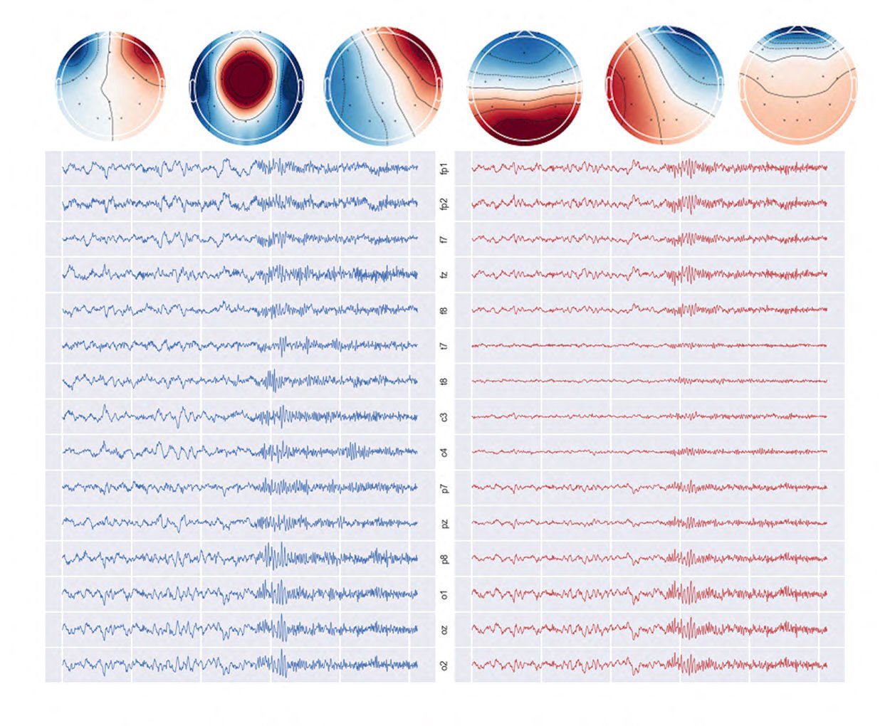 How AI could monitor your brain health and find dementia sooner