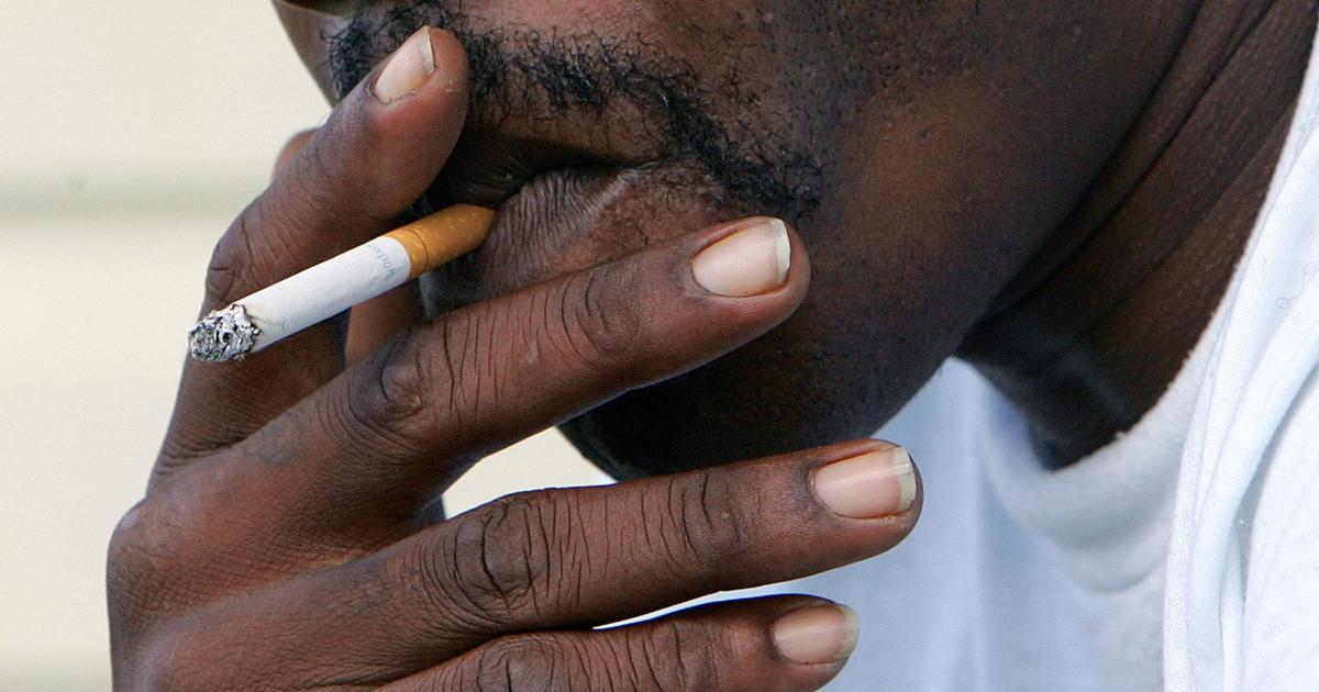 is chewing tobacco bad for diabetes All of these patients use or used smokeless tobacco. Swipe to see some of the spectrum of lesions we see in patients who use smokeless tobacco. We can see similar effects with