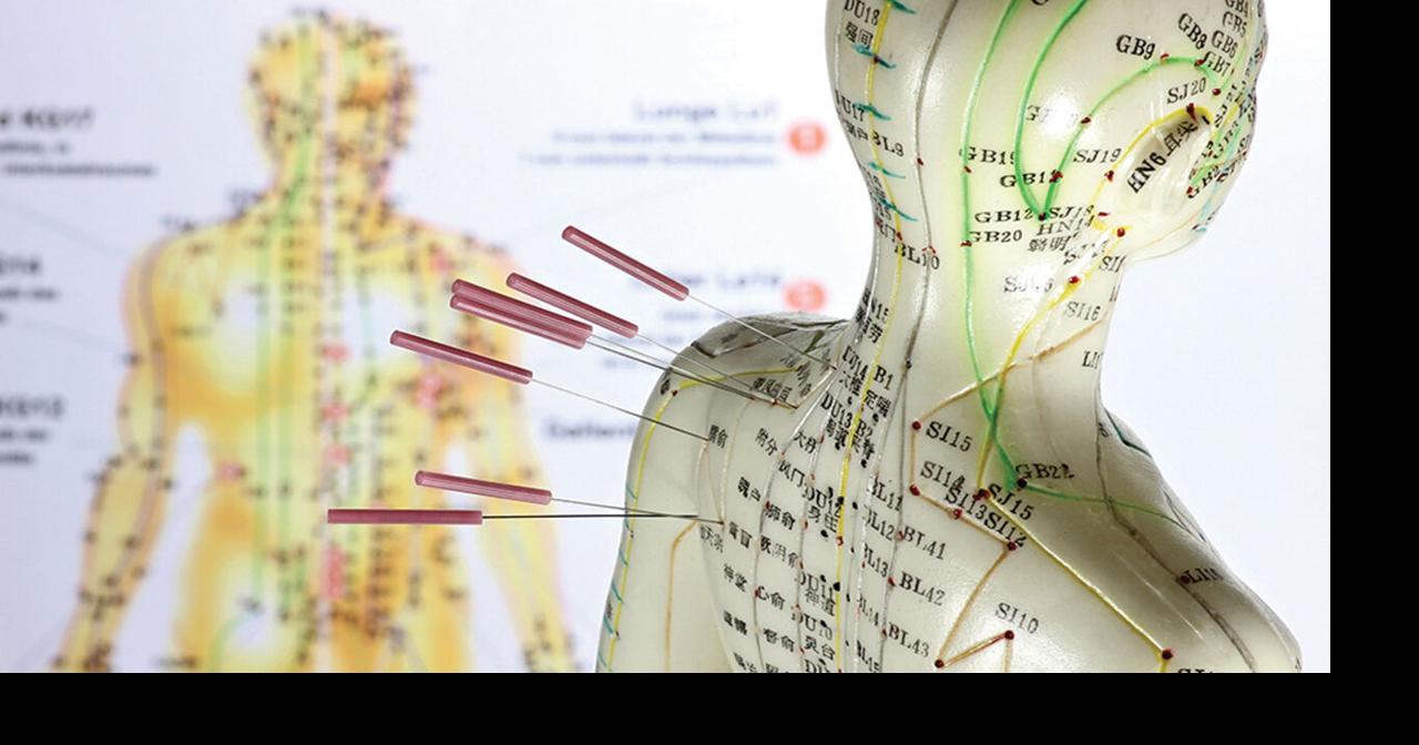 The Whole Point: Acupuncture is the ideal treatment for pain ...