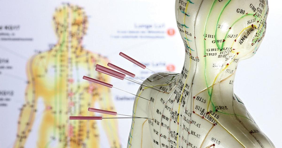 The Whole Point: Acupuncture is the ideal treatment for pain ...