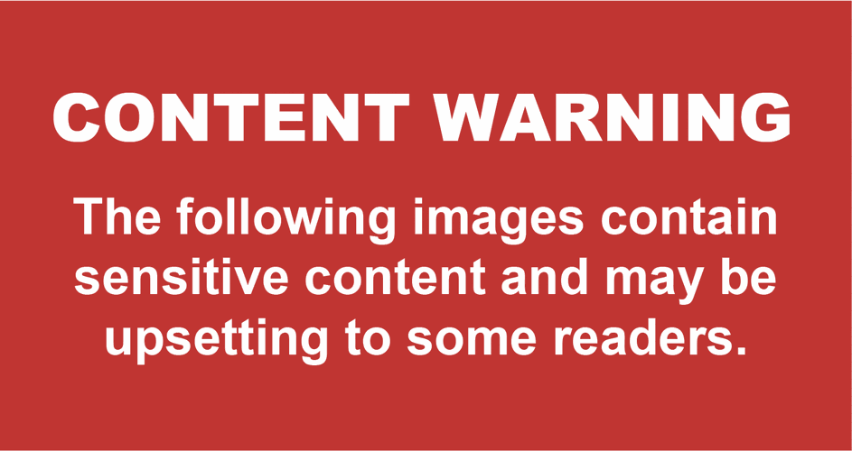 Content warning logo