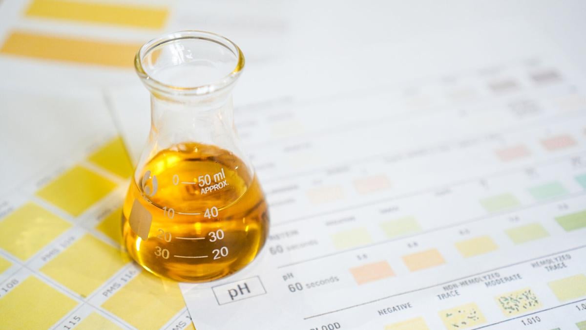 medicine-cabinet-urine-20210707
