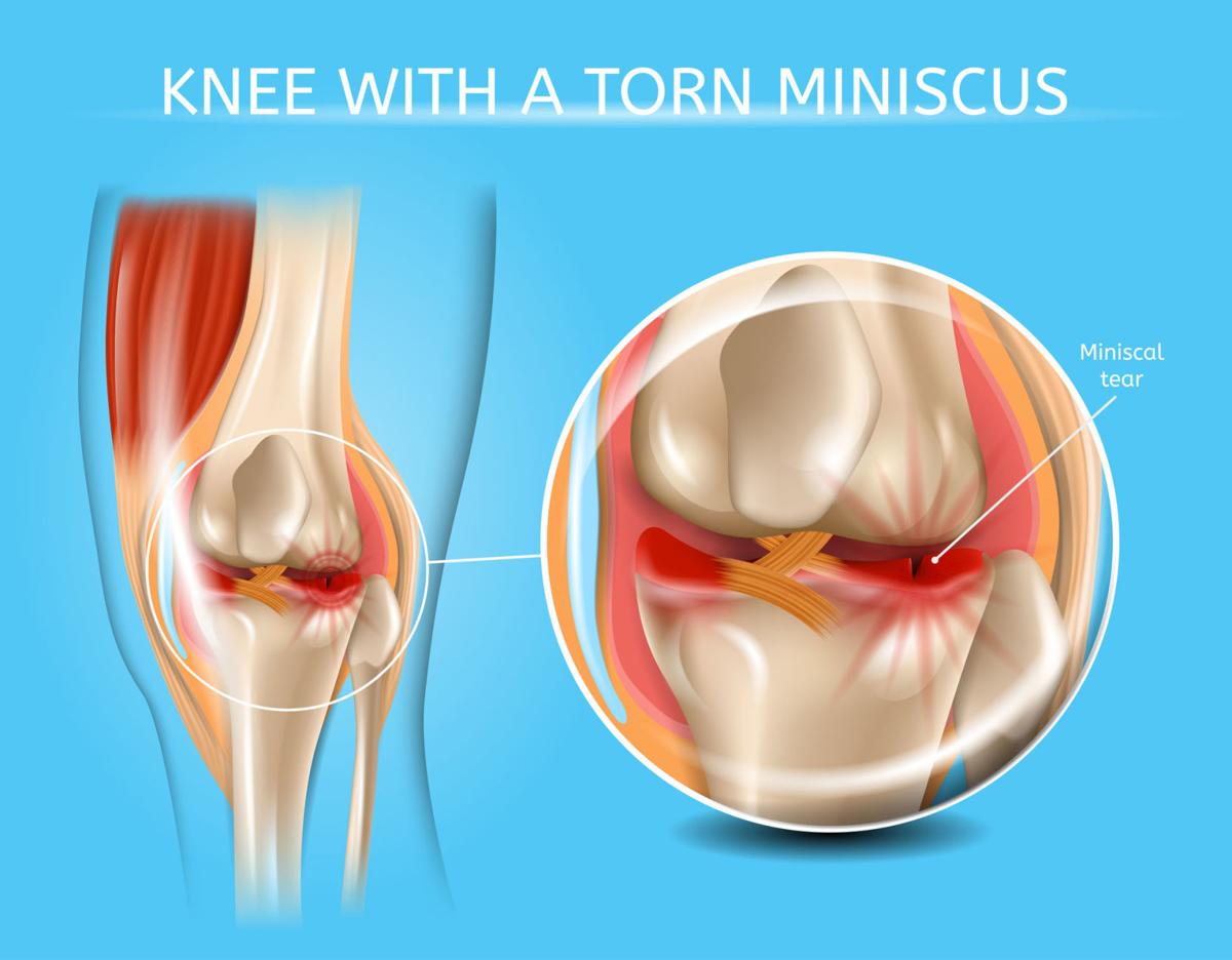 MENISCUS