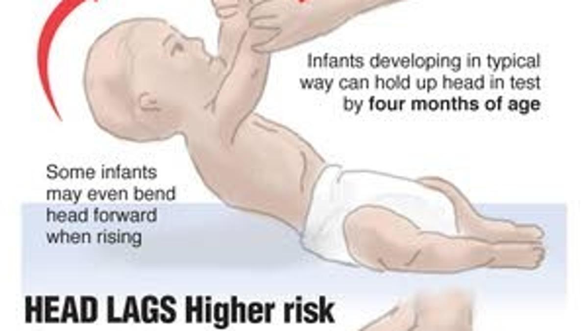 Pull Sit Test Can Indicate Autism As Early As 6 Months Archive Pressofatlanticcity Com Pull Sit Test Can Indicate Autism As Early As 6 Months Archive Pressofatlanticcity Com