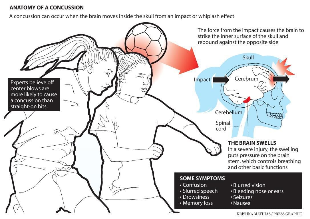 Local coaches, players combating concussions with technique, exercises