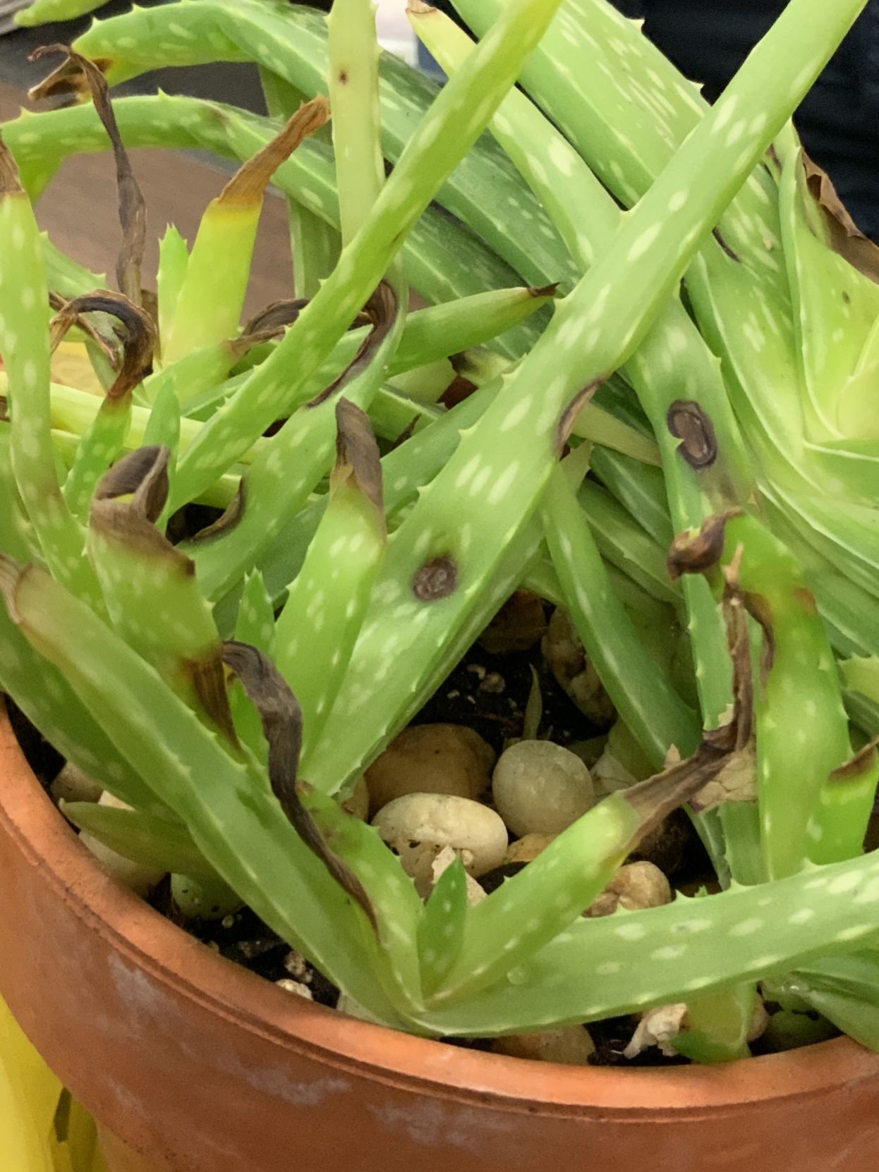 Aloe Problems Can Result From Overwatering, Poor Drainage, Disease