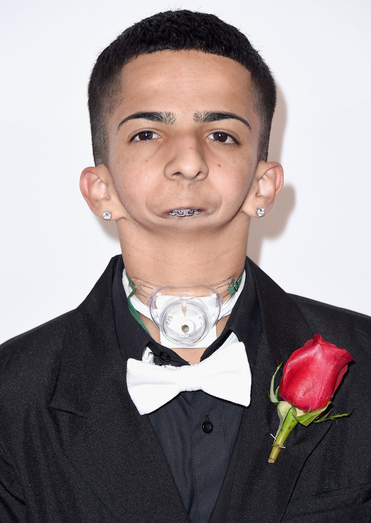 ACE