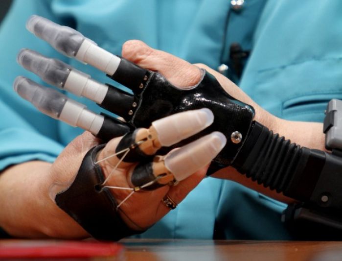 Woman's futuristic prosthetics give her back use of both hands