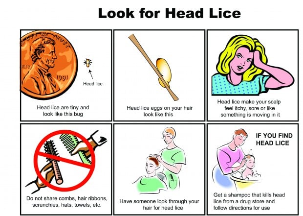 head lice can affect anyone