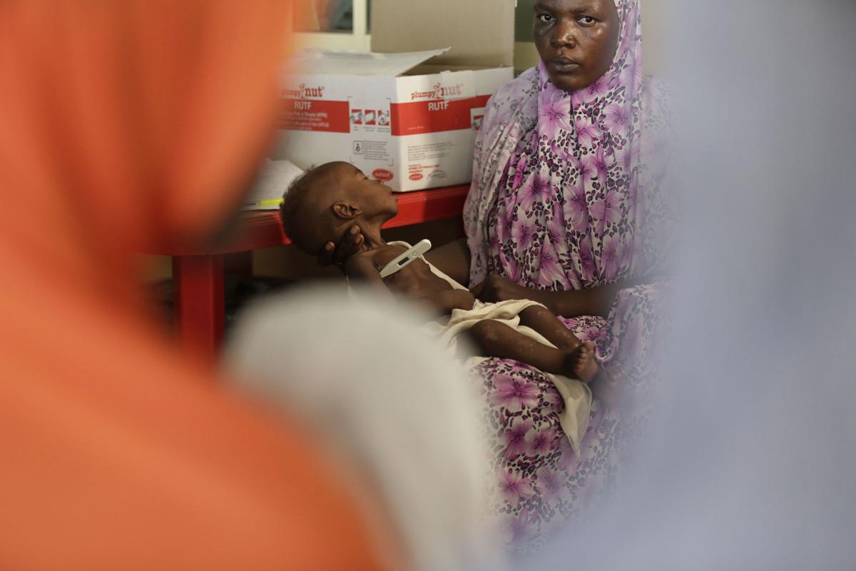 Nigeria Starving Children