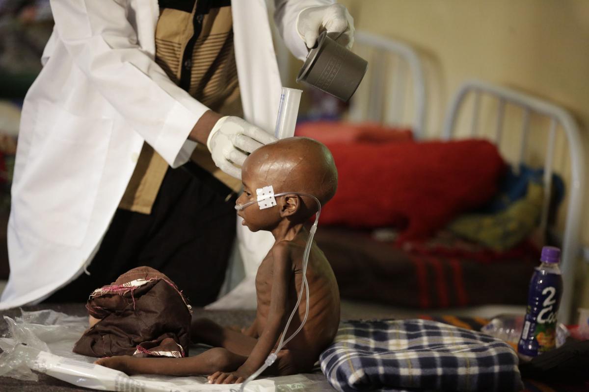 Nigeria Starving Children