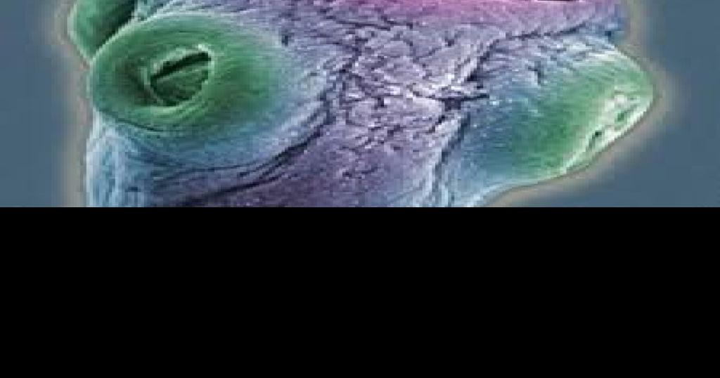 Tapeworms Risky way to lose weight