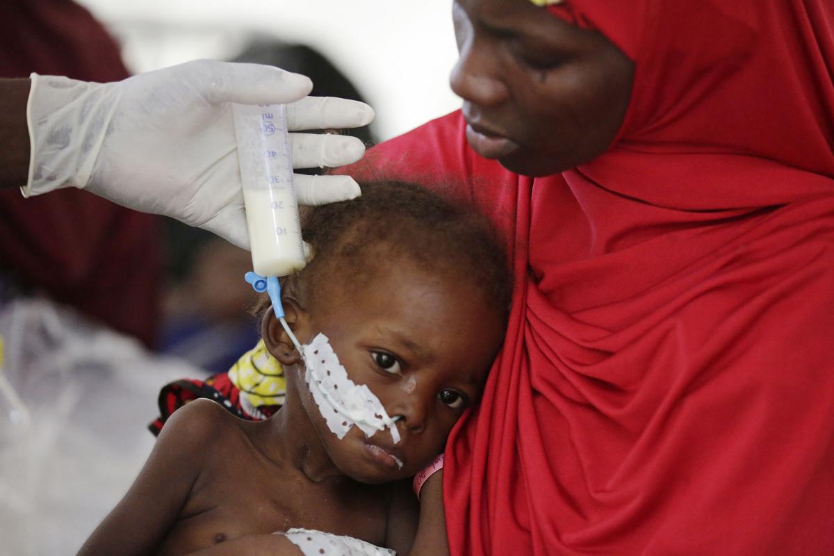 Nigeria Starving Children